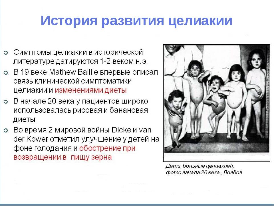 Целиакия. симптомы, диагностика и лечение целиакии.