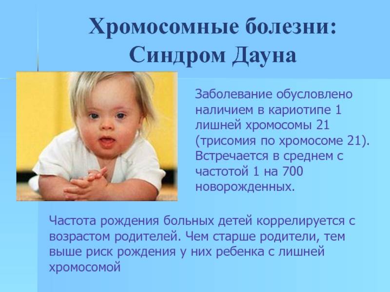 Дети с синдромом Дауна: причины, признаки, симптомы у новорожденных