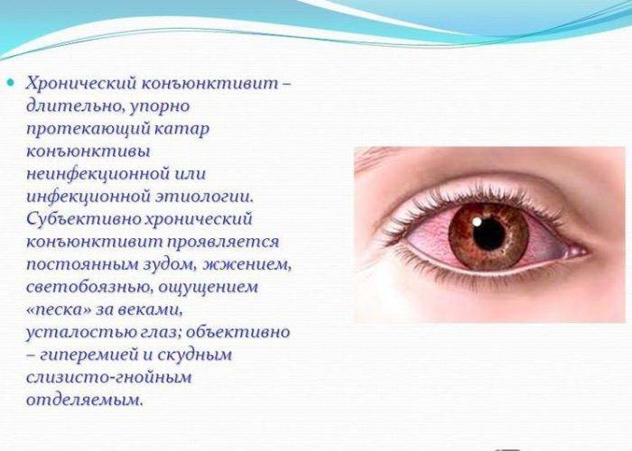 Глазные болезни у детей, узнайте про детские болезни глаз.
