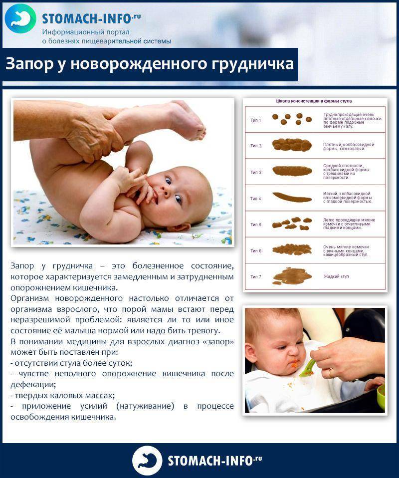 Колики у младенцев: симптомы, диагностика, лечение и профилактика - причины, диагностика и лечение
