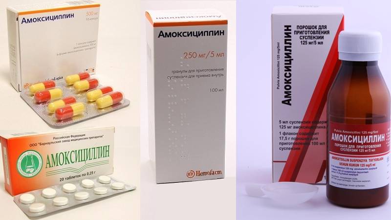 Антибиотики при лимфадените у взрослых и детей: какие, инструкция по применению | компетентно о здоровье на ilive