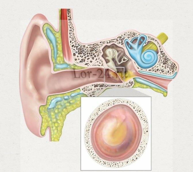 Снижение слуха, причины и лечение снижения слуха перцептивного типа на высоких и низких частотах на оба уха, шум в ушах