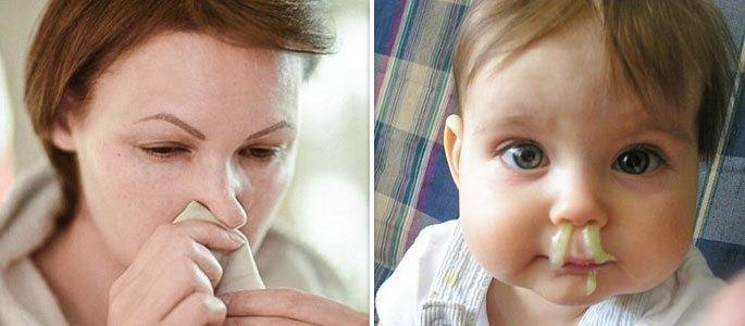 Что вызывает неприятный запах в носу?