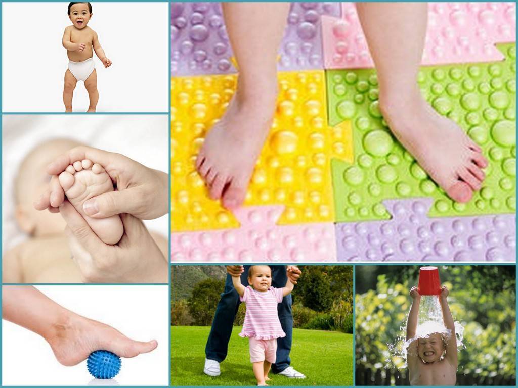 Как лечить плоскостопие у детей. причины, симптомы, диагностика, профилактика и методы лечения