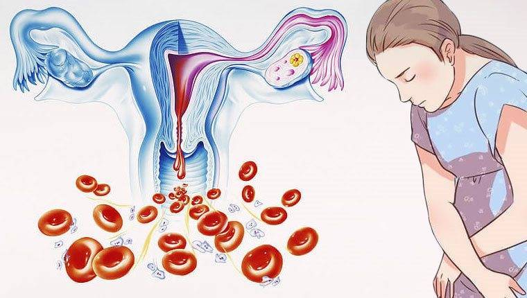 Синдром гиперторможения яичников: отсутствие менструации после противозачаточных