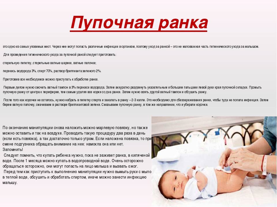 Внимание — пупок!  обработка пупка новорожденного в роддоме и дома