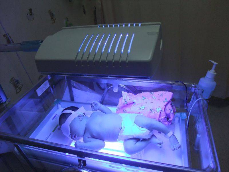 Норма билирубина у новорожденных