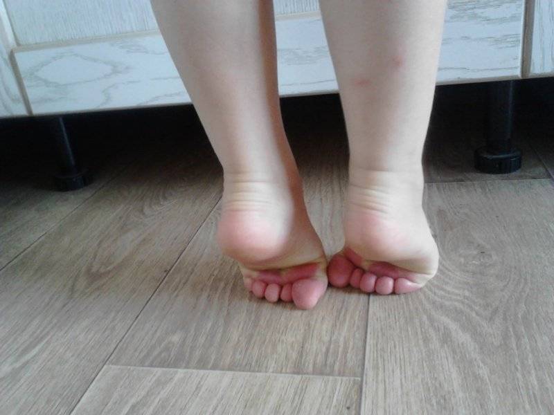 Почему малыш, мальчик, девочка стоит на цыпочках, плохо стоит на ножках, куда обращаться? нужен ли массаж?
