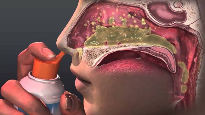 Лечение выделений из носа: капли, лекарства, таблетки | компетентно о здоровье на ilive