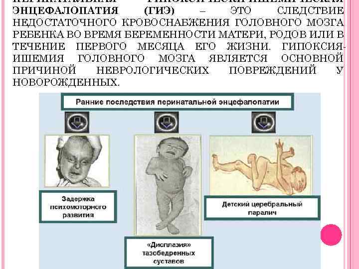 Лечение перинатальной энцефалопатии у детей в москве – доктор никонов