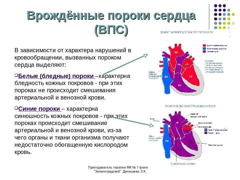 Коррекция врожденного порока сердца