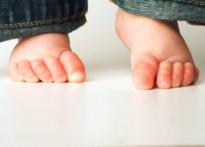 Почему ребенок стоит на цыпочках, пальчиках, плохо стоит на ножках, не стоит: что делать, как лечить, стоять