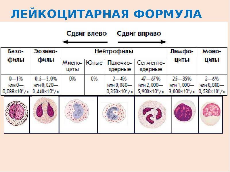 Лейкоцитарная формула крови: расшифровка у детей анализа и норма в таблице