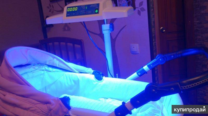 Фототерапия при желтухе у новорожденных: лечение в домашних условиях с помощью лампы