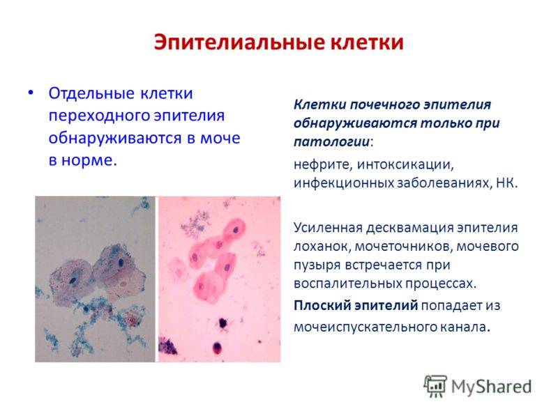 Инфекции мочевыводящих путей (имвп) у детей. информация для родителей.