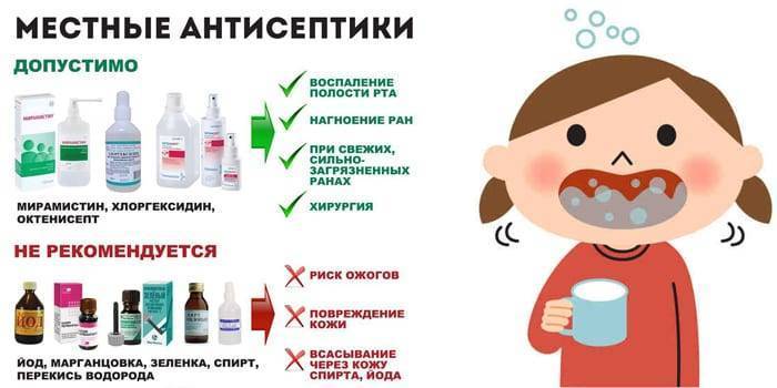 Лечение вирусного, гнойного, афтозного и острого стоматита у детей. лечение стоматита у маленьких детей в цэлт