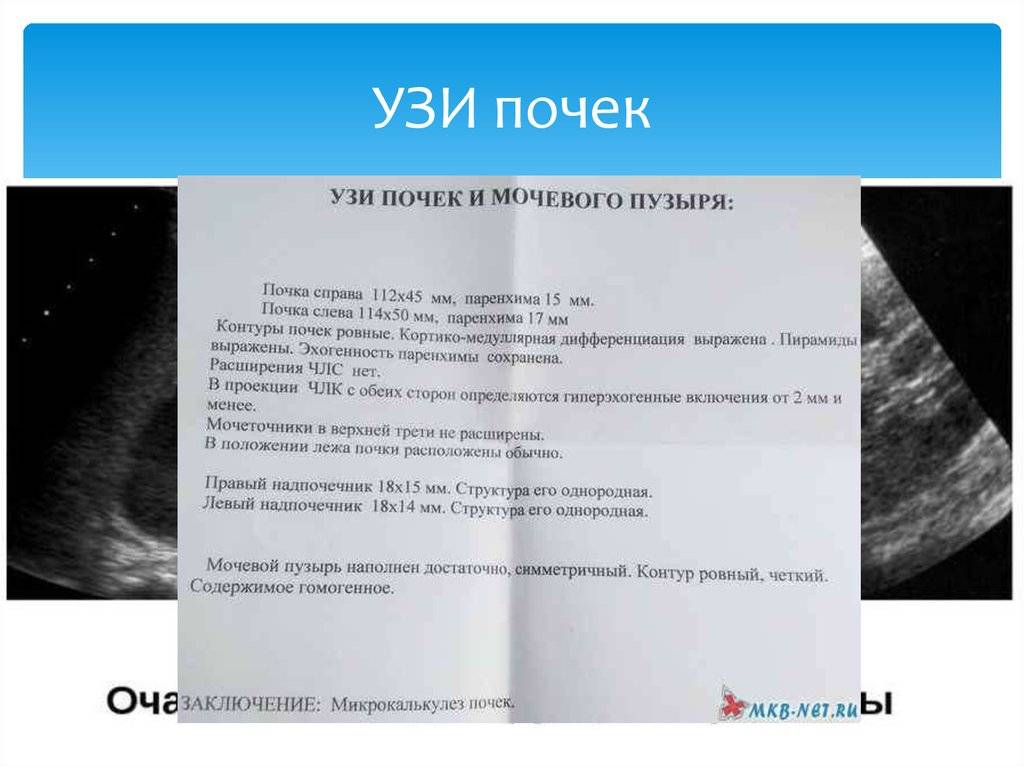 Узи почек и мочевого пузыря ребенка: подготовка к исследованию, размеры норм по таблице, как подготовить малыша, причины увеличений