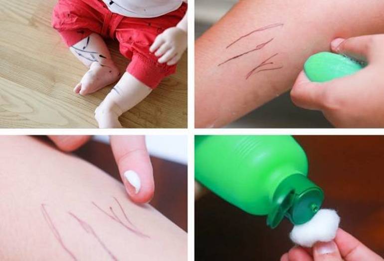 Чем отмыть фломастер с кожи ребенка - простые средства в домашних условиях