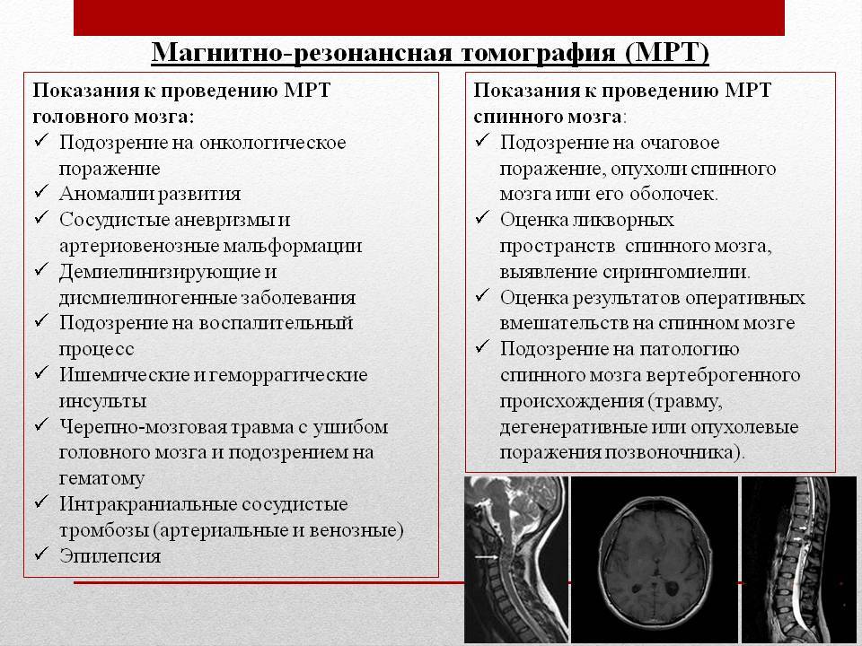 Мрт головного мозга - современная и точная диагностика