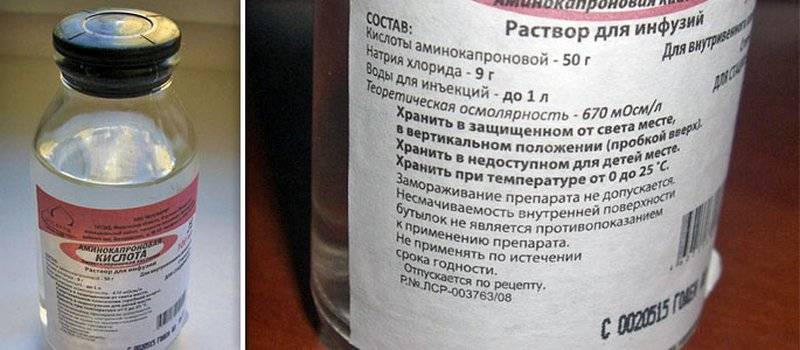 Ингаляции при насморке. как делать в домашних условиях детям и взрослым