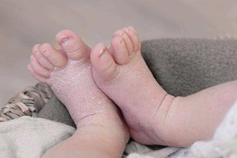 У новорожденного холодные ручки и ножки: причины и рекомендации