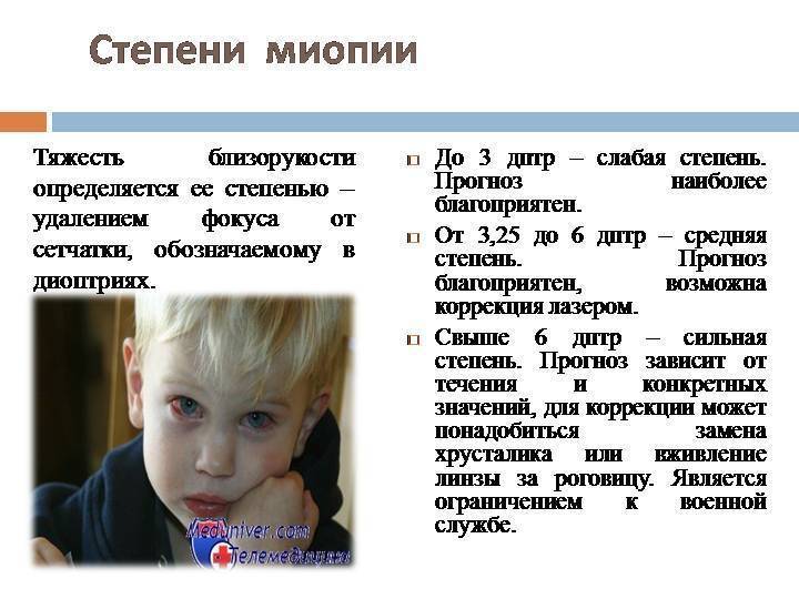 Упражнения для профилактики близорукости у детей - энциклопедия ochkov.net