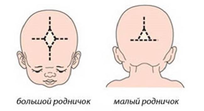 Асимметрия головы у грудничка – повод бить тревогу?