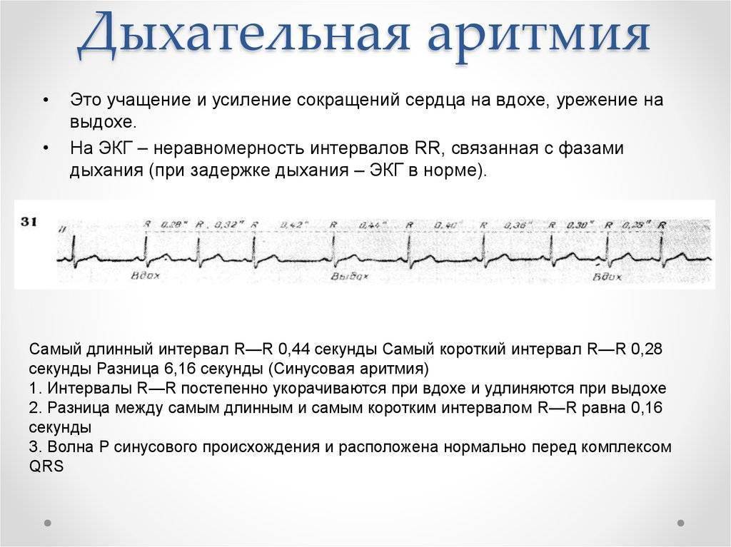 Аритмия дыхания | симптомы | диагностика | лечение - docdoc.ru