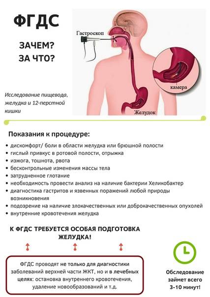 Гастроскопия желудка и колоноскопия сделать в москве (фгдс, эгдс) | медицинский центр «президент-мед»