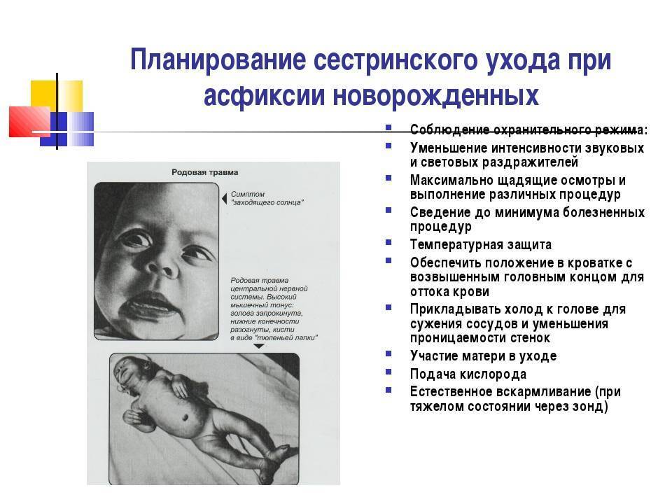Асфиксия новорожденных. причины возникновения асфиксии у новорожденных. степени тяжести асфиксии новорожденных. реанимация и лечение при асфиксии. последствия и профилактика асфиксии