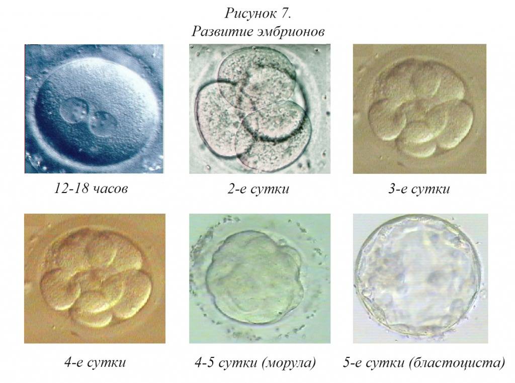 Как происходит замораживание эмбрионов?