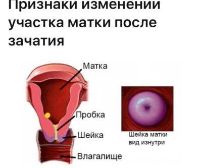 Какой должна быть шейка матки накануне месячных и при беременности на ощупь, где она бывает расположена и как выглядит