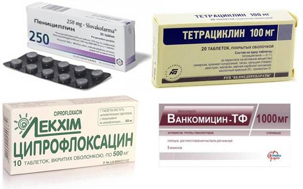 Аллергический отек гортани