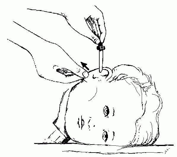 Правила закапывания капель в носик новорожденному особенности процедуры