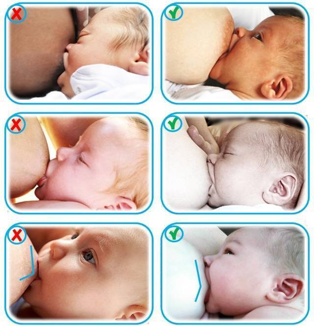 Новорожденный ребенок плачет после кормления, извивается, тужится: почему? - мытищинская городская детская поликлиника №4