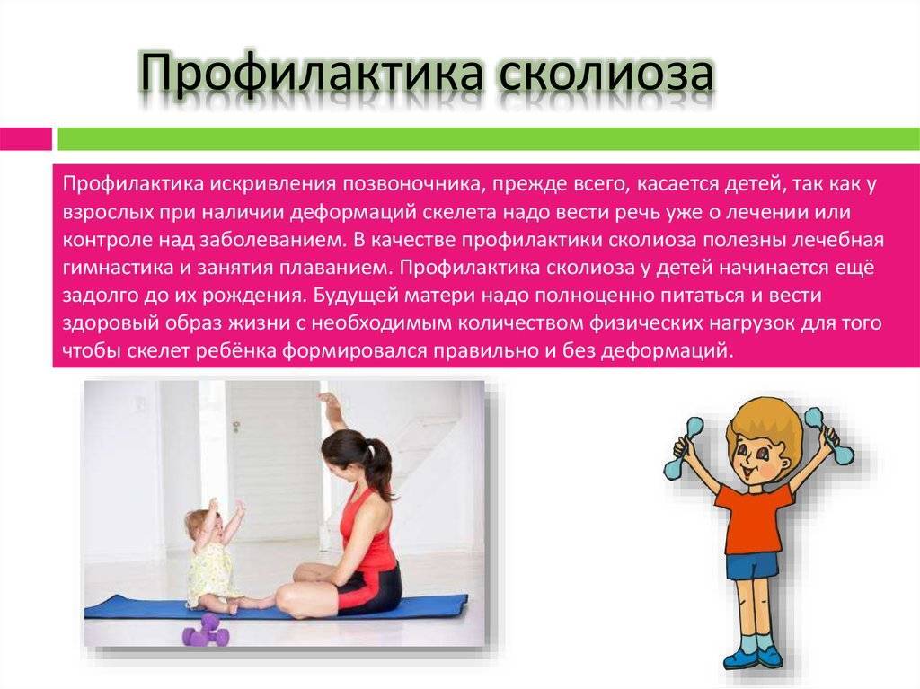 Нарушение осанки у детей, лечение, виды, профилактика дошкольного возраста и подростков в москве