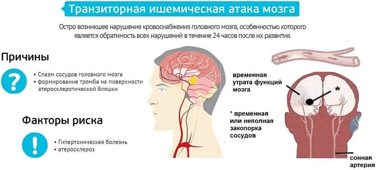 Диагностика и лечение ишемии головного мозга (сергиев посад) | парацельс